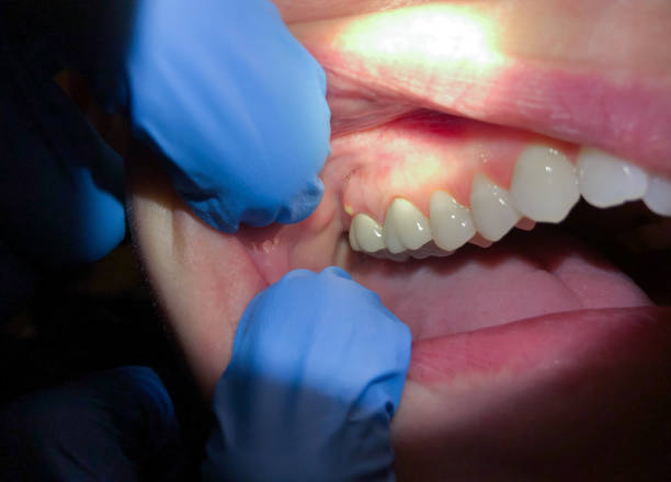 Best Walk-In Emergency Dentist in Rocky Point, NC