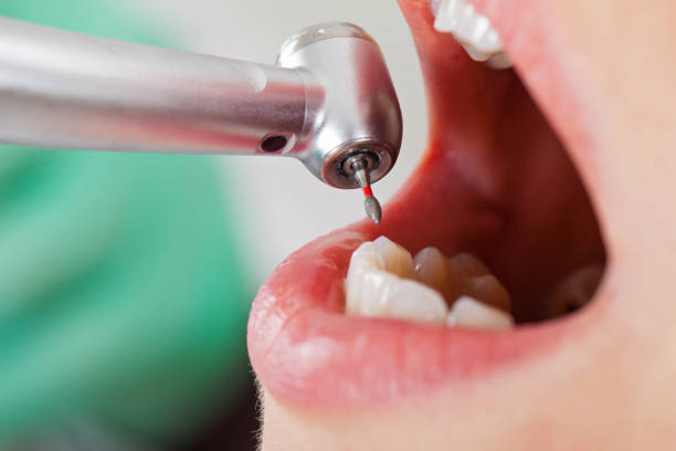 Best Emergency Broken Tooth Repair in Rocky Point, NC